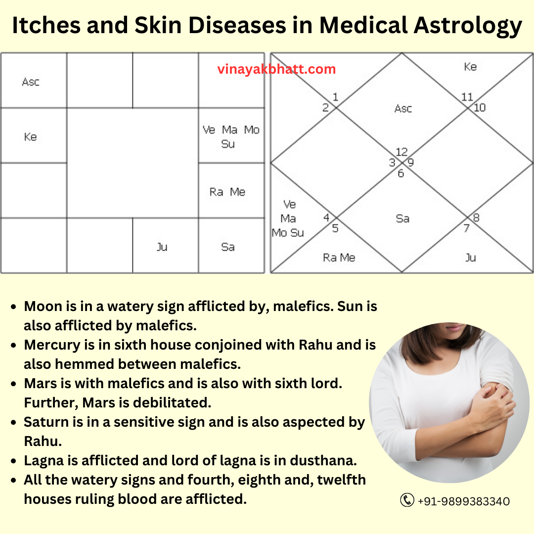 Itches and Skin Diseases in Medical Astrology